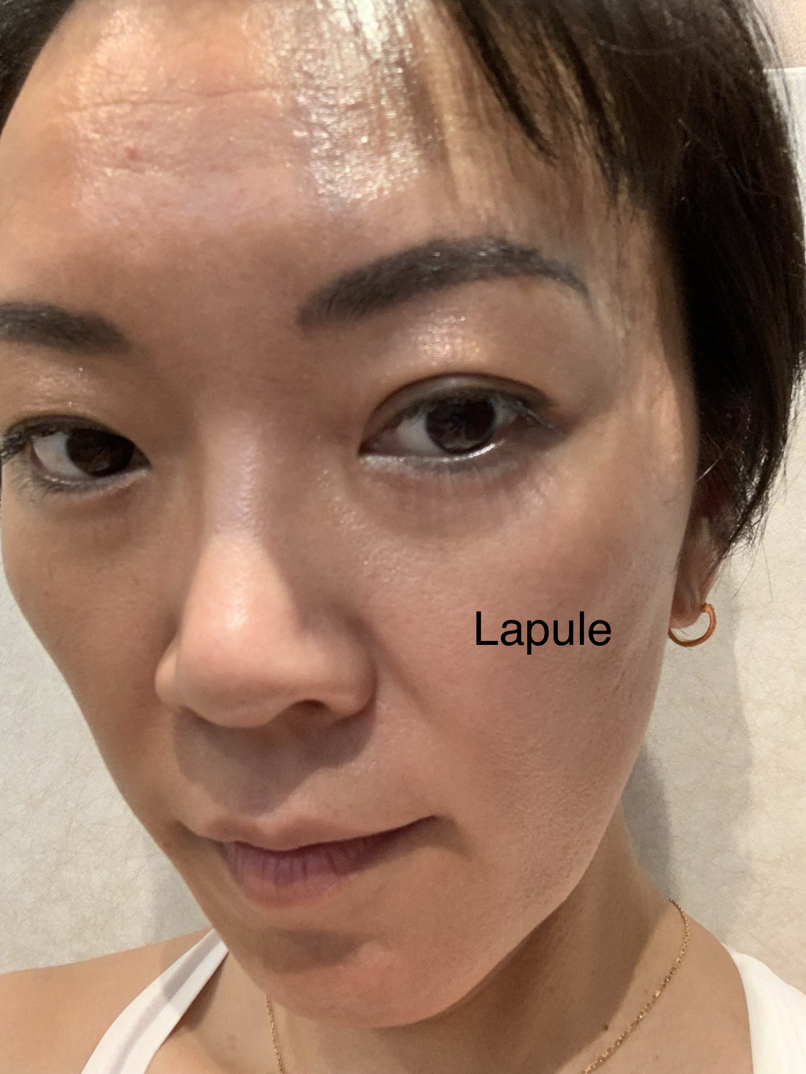 バイオウォーミーパック 横浜シュガーリング ブラジリアンワックス脱毛サロンlapule